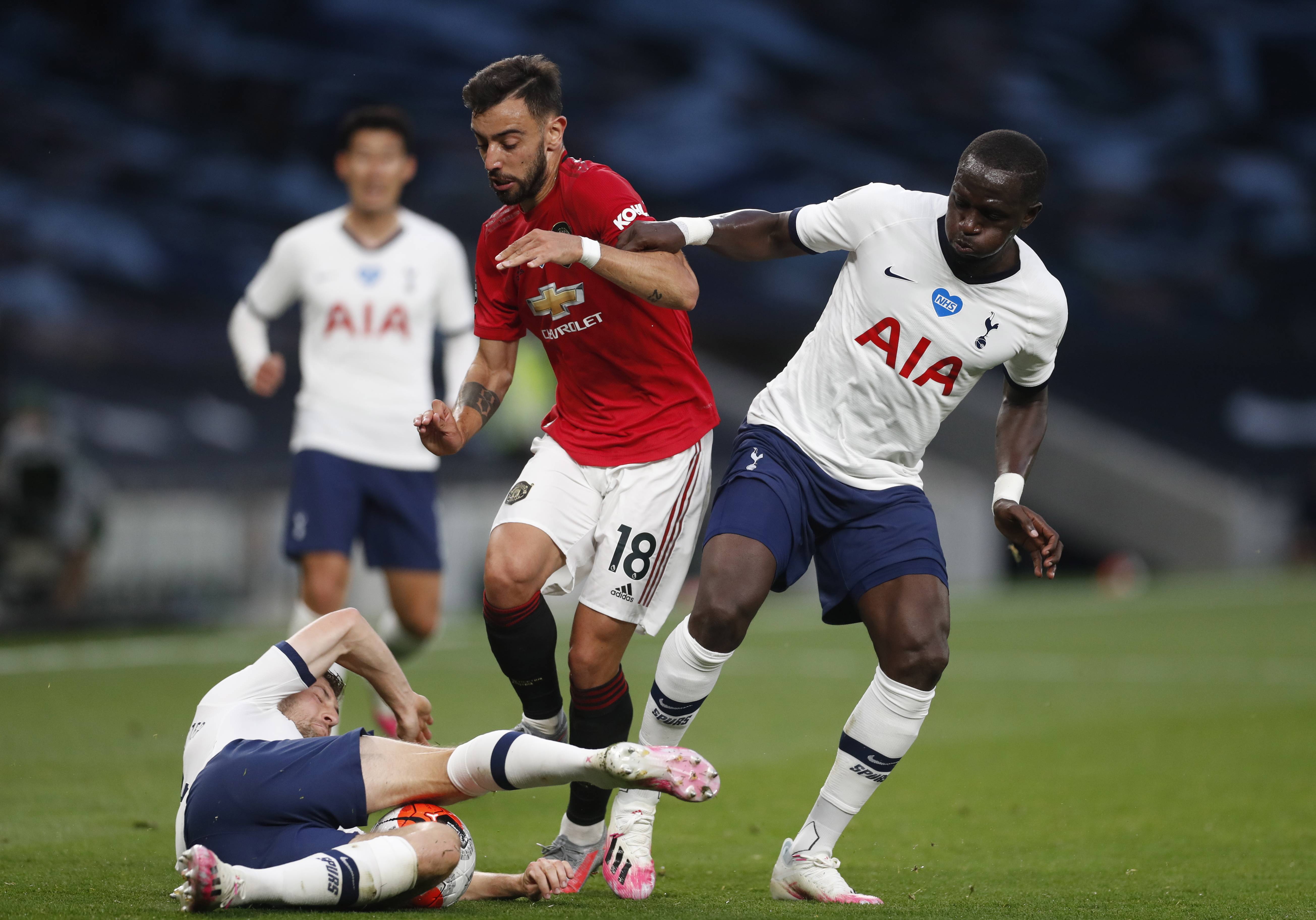 浓眉缺阵带 浓眉缺阵带